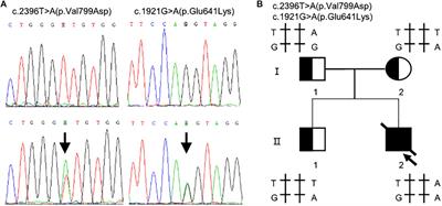 Novel Compound Heterozygous TMPRSS15 Gene Variants Cause <mark class="highlighted">Enterokinase</mark> Deficiency